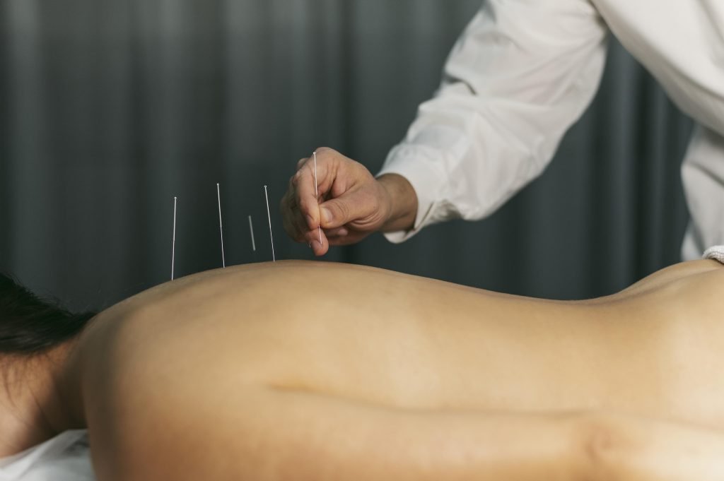Acupuncturist in Nijmegen