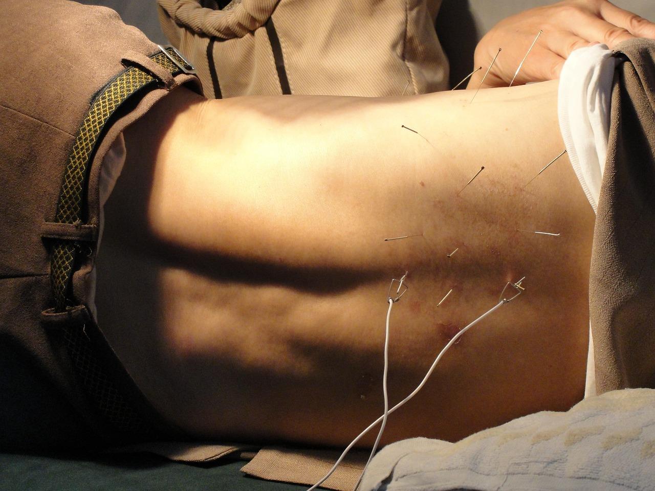 Acupuncturist in Nijmegen